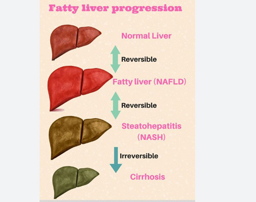 Basic and Clinical Anatomy of Liver